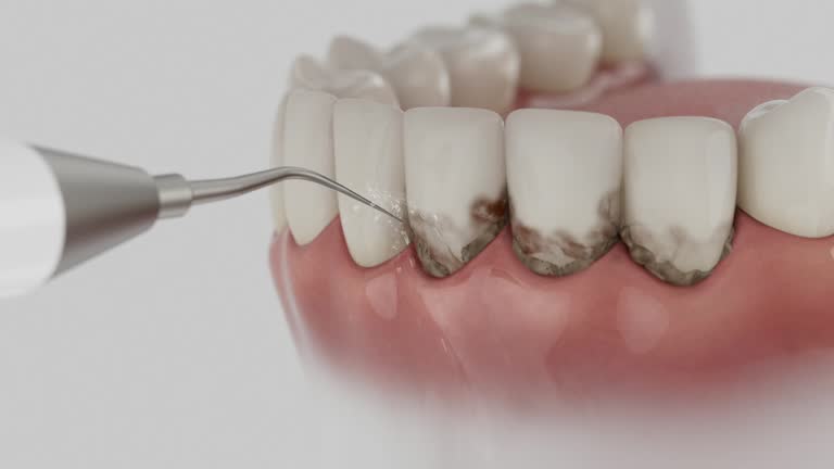 Trusted Wisdom Tooth Removal service in Patrick Springs, VA - Dentist Open Now